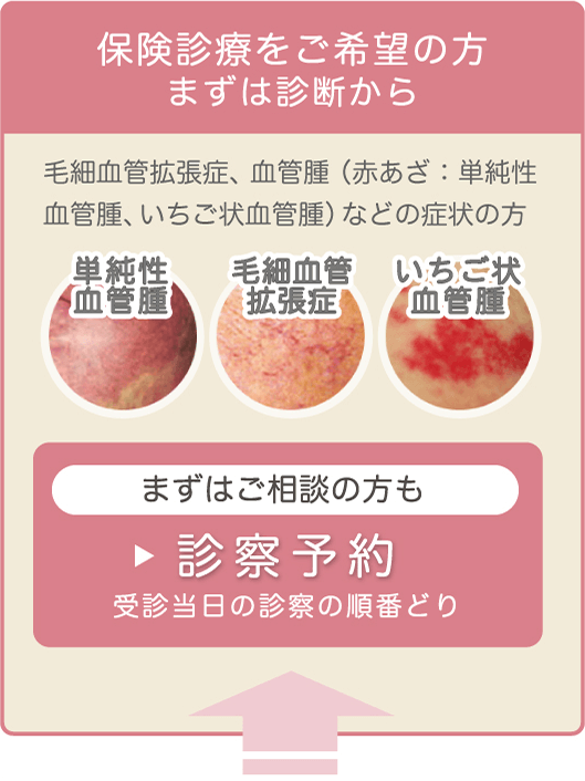 保険診療をご希望の方まずは診断から。毛細血管拡張症、血管腫(赤あざ:単純性血管腫、いちご状血管腫)などの症状の方。まずはご相談の方も診察予約(受診当日の診察の順番どり)