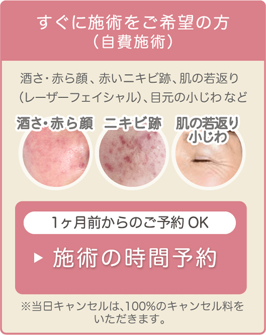 すぐに施術をご希望の方(自費施術)酒さ·赤ら顔、赤いニキビ跡、肌の若返り(レーザーフェイシャル)、目元の小じわなど。1ヶ月前からのご予約OK。施術の時間予約。※当日キャンセルは、100%のキャンセル料をいただきます。