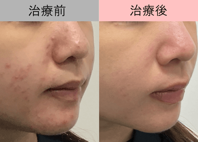 治療前と治療後